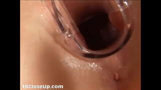 Julia Gynécologique Examen et la Chatte à l'Exploration (disponible en FullHD)