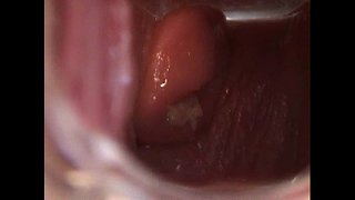 Avy Open teen Topanga ki te Karaehe